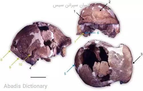 انسان سپرانن سیس